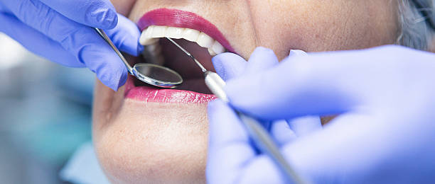 Best Emergency Dentist for Knocked-Out Tooth in Fountainhead Orchard Hills, MD